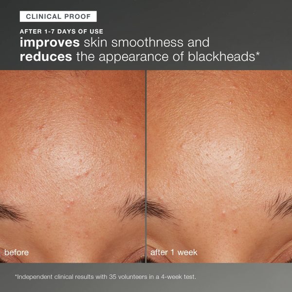 Dermalogica Daily Microfoliant, Face Exfoliator Scrub Powder with Salicylic Acid and Papaya Enzyme, Achieve Brighter, Smoother Skin Daily - Image 8