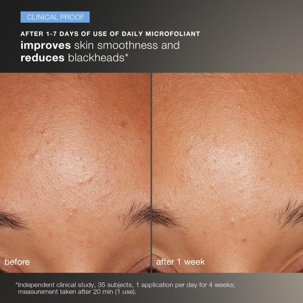 Dermalogica Discover Healthy Skin Kit - Includes: Precleanse, Face Wash, Face Exfoliator, & Moisturizer - Wash Away Impurities To Reveal Glowing Skin - Image 4